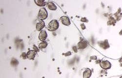 Plankton aus dem Teich